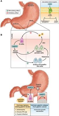 Gastrin Vaccine Alone and in Combination With an Immune Checkpoint Antibody Inhibits Growth and Metastases of Gastric Cancer